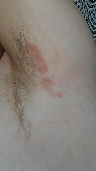 Usuwanie plam pod pachami
